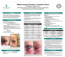 MRSA Preseptal Cellulitis in a Pediatric Patient
